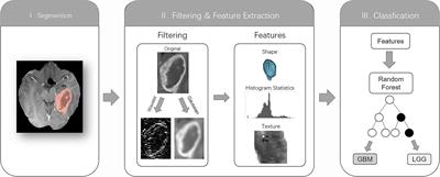 Preoperative Contrast-Enhanced MRI in Differentiating Glioblastoma From Low-Grade Gliomas in The Cancer Imaging Archive Database: A Proof-of-Concept Study